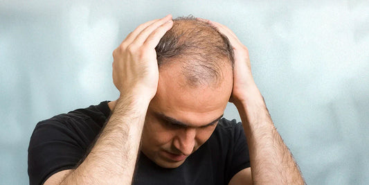 The Hidden Link Between Stress and Your Hair — And How Adivasi Herbal Hair Oil Can Restore Balance